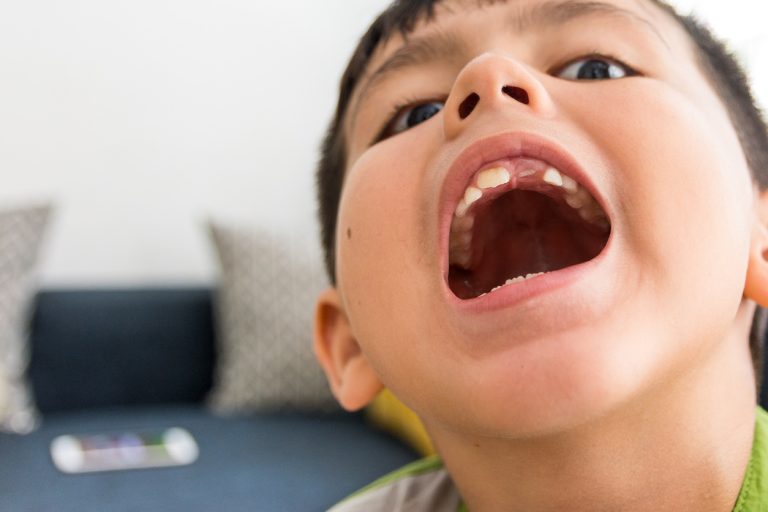 A young boy smiles broadly, displaying his teeth with joy and enthusiasm.