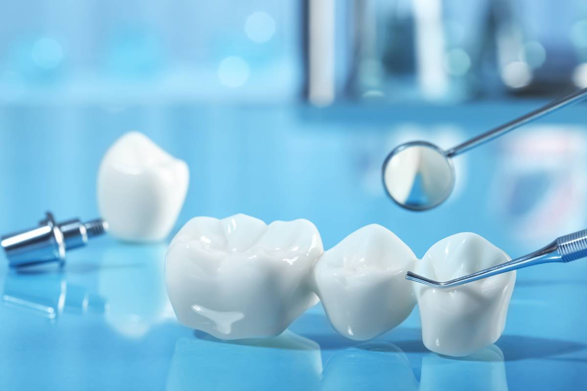 A collection of dental tools and tooth models arranged neatly on a table, showcasing dental care equipment and education.