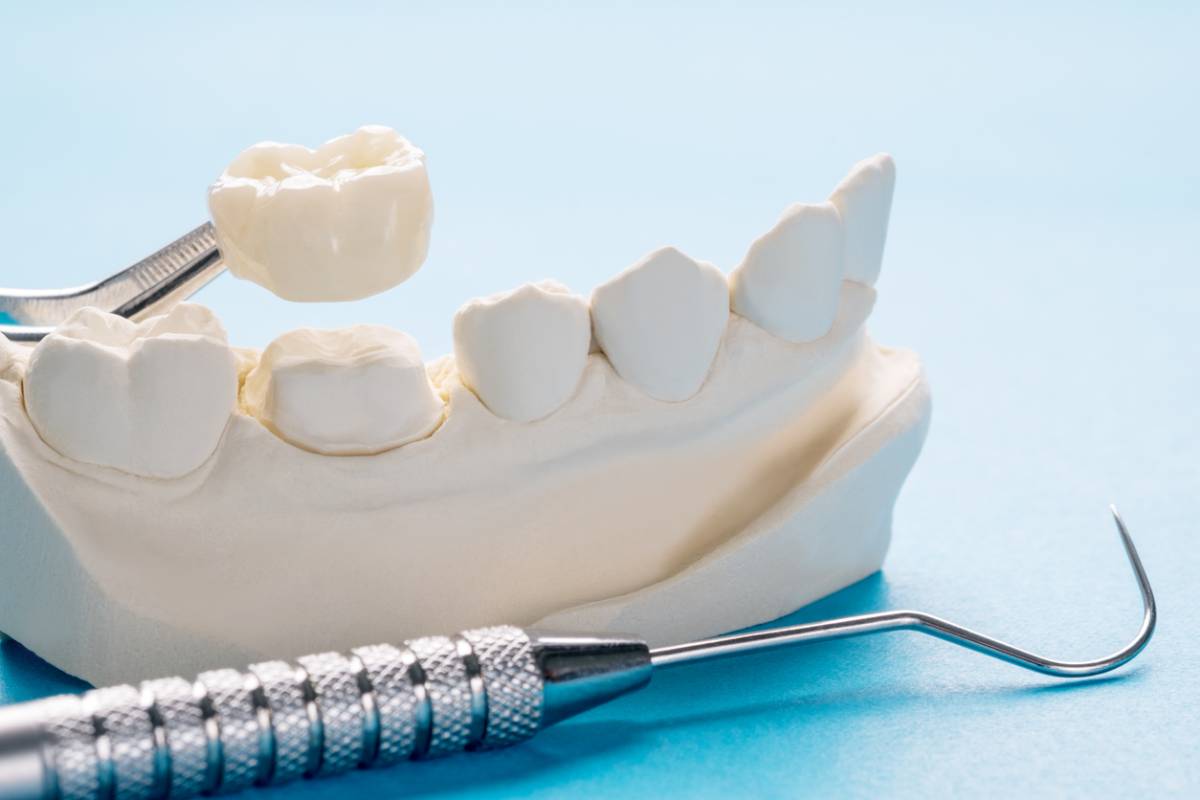 A dental model featuring a toothbrush positioned next to a single tooth, illustrating oral hygiene practices.