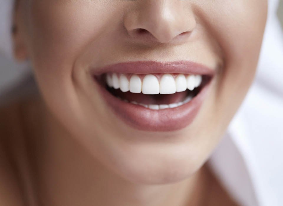 A woman with bright white teeth smiling warmly, showcasing her joyful expression and confidence.