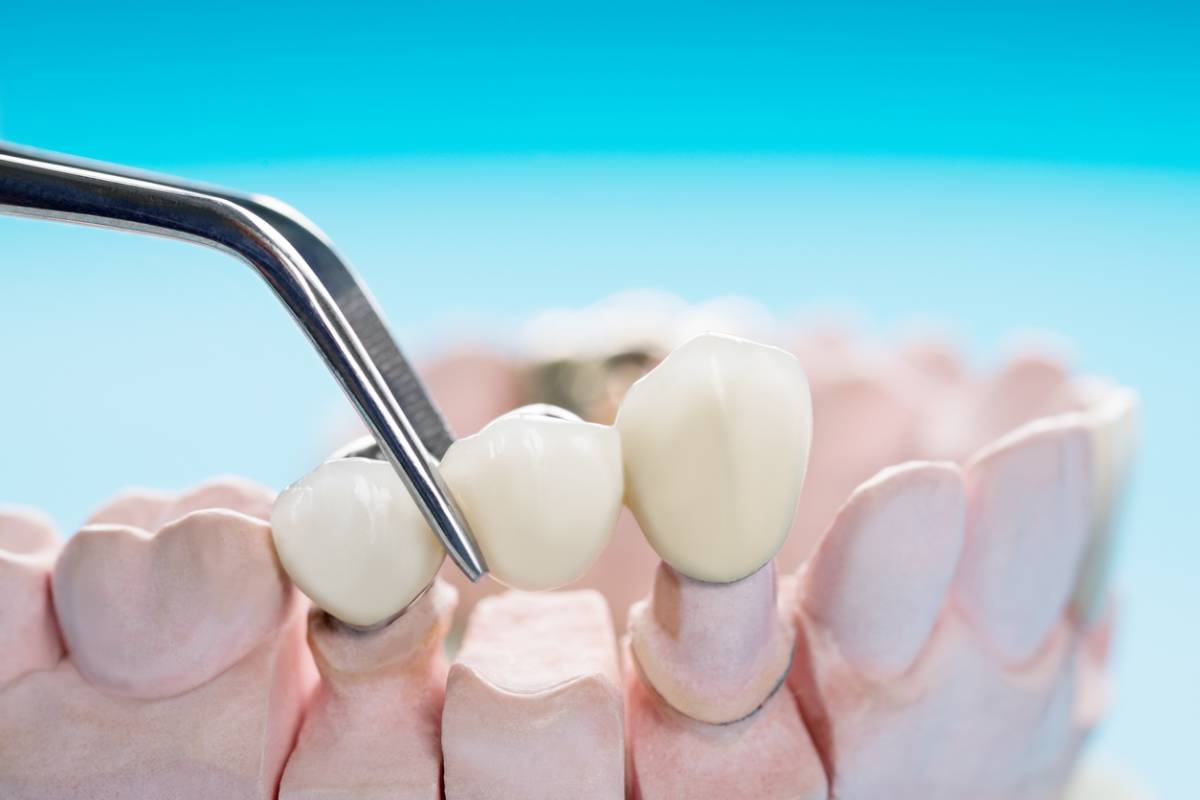 A dental professional uses a tool to extract a tooth from a patient's mouth in a clinical setting.