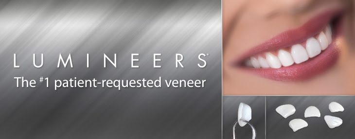 A close-up of the Lumineers dental implant system showcasing its innovative design and advanced technology for dental restoration.