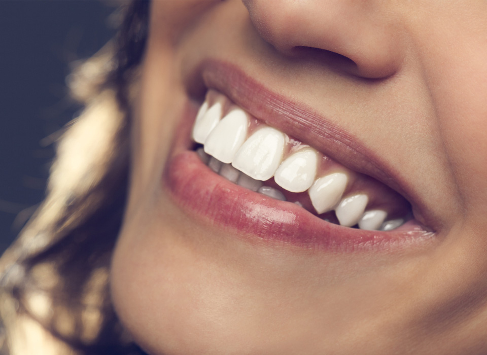 A woman with bright white teeth smiles warmly, showcasing her cheerful demeanor and confidence.