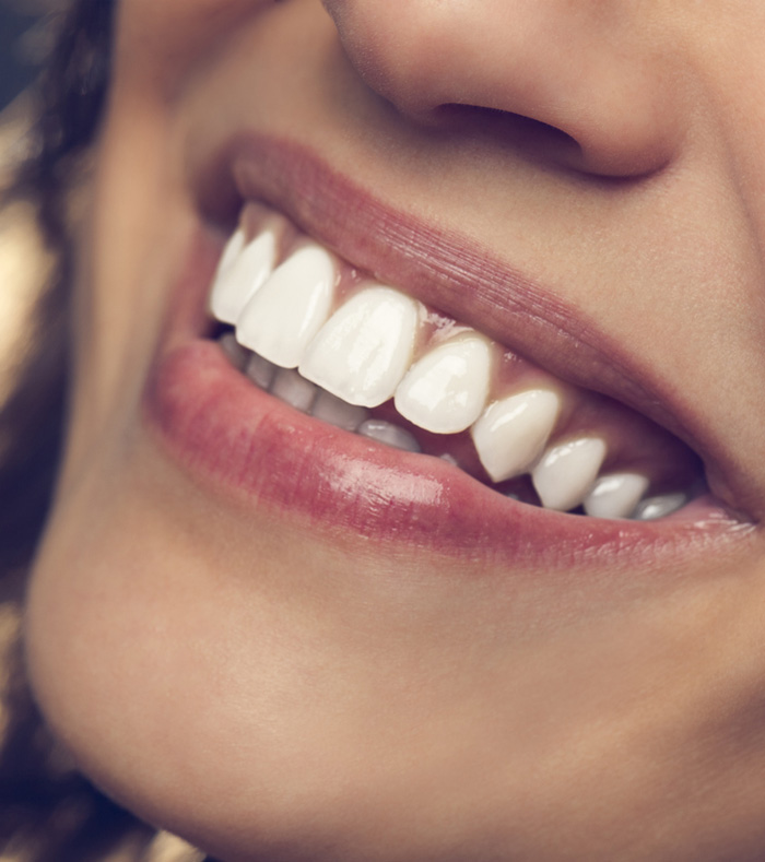 A woman with bright white teeth smiles warmly, showcasing her cheerful demeanor and confidence.