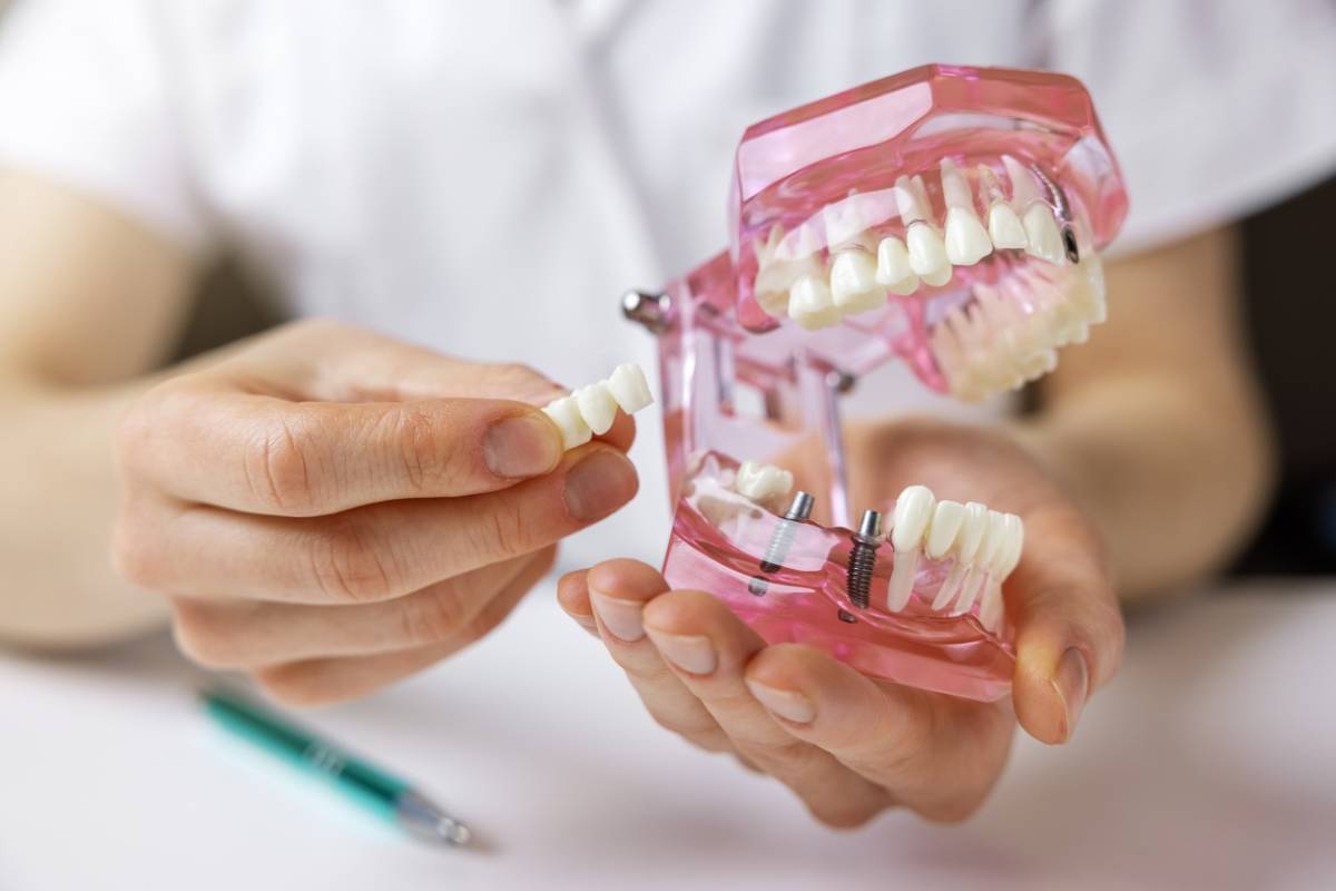 Featured image for How to Care for Your New Dental Bridge