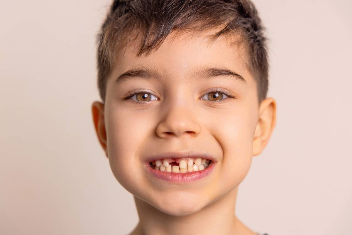 kid with missing milk teeth, close up portrait photography