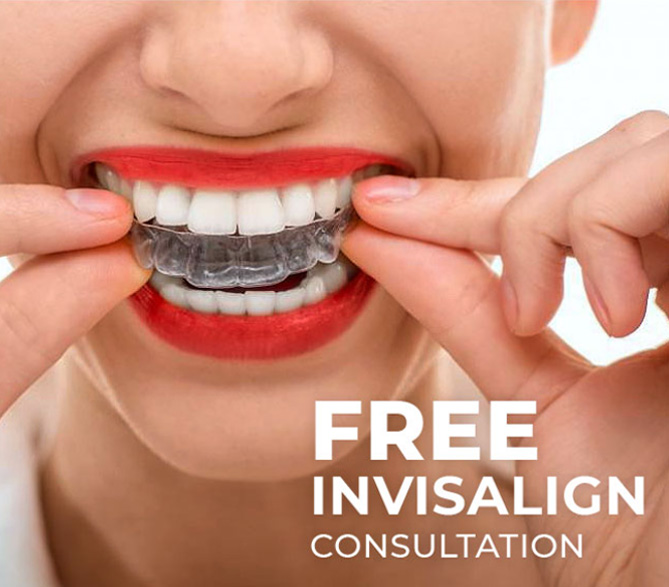 Woman wearing Invisible braces aligner stock photo