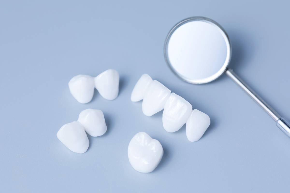 concept image of dental bridges aftercare