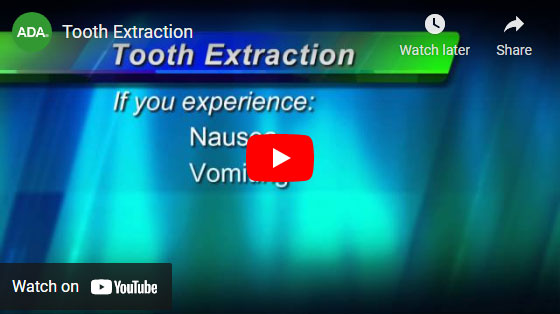 Tooth Extraction video